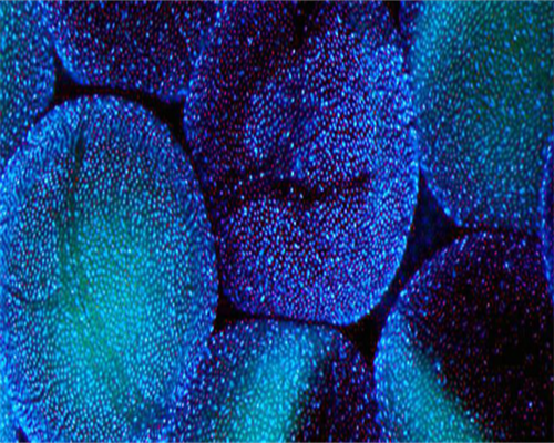 
              代生孩子咨询冻胚移植前雌二醇3000会影响着床成功率吗？
         