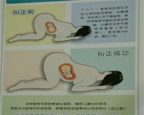 激素六项检查多少钱 性激素六项什么科可以开单