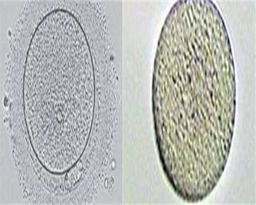 精子和卵子结合能做试管吗