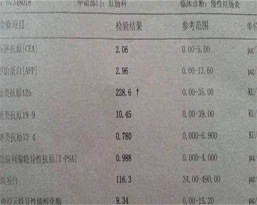 代生公司包成功检查之后马上就能进周不同代生公司包成功方案的进周时间不相