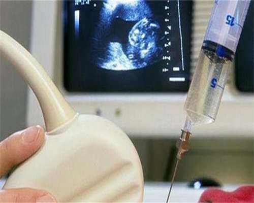 国外捐卵网站_正规的代孕网站,
              怀孕8周胎停是染色体异常还是母体子