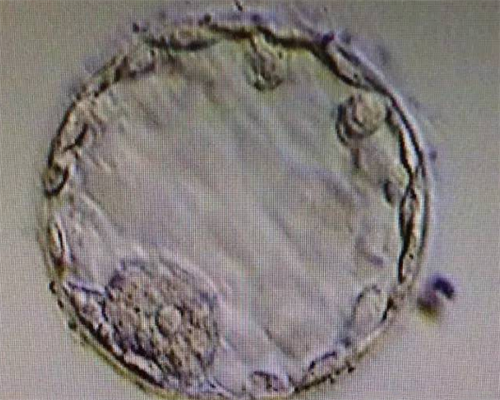 哪做试管代生好打降调针注意事项多？成功率有多高！