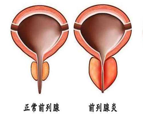 供卵价钱表-闭经泌乳综合征要怎么办（闭经的危害）