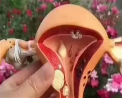 
              输卵管积水患者要积极调整饮食，不可以吃辛辣食物吗？
          