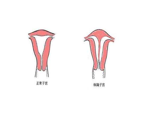 代孕儿子医院,什么原因引起卵巢早衰？遗传和感染要重视需尽早治疗