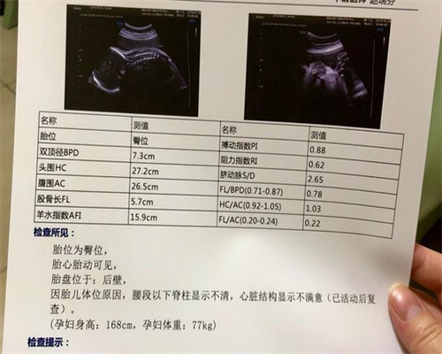 青岛三代试管青岛三代试管包生男孩