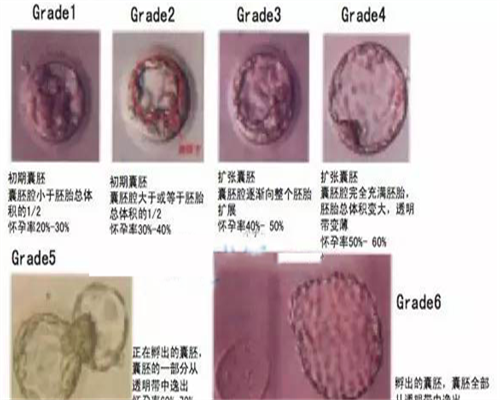 阴超检查前后4大注意事项揭秘，空腹和憋尿其实都不要！
