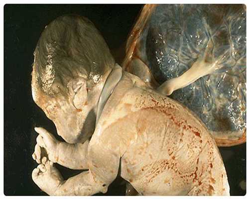 菏泽代孕产子网：孕晚期如何进行胎教？孕晚期