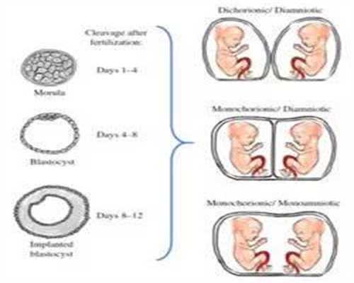 廊坊代孕网站：孕早期除了补叶酸，以下这四种