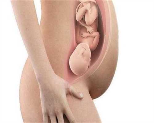 呼和浩特代孕论坛：怀孕7周阴道出血是什么原因