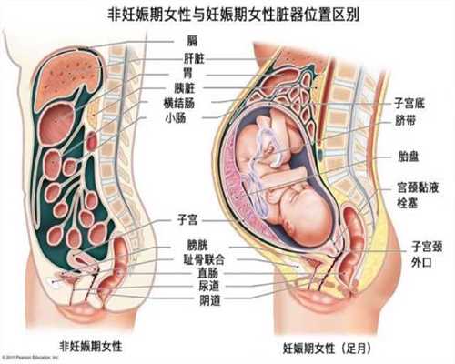 代孕五个月胸部痒怎么回事_助孕宝有什么功效