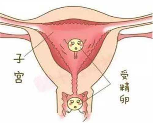 广州高鹰代孕哪里正规怀代孕后要多吃它，再贵