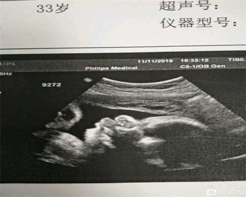 儿童卵巢发育不全会肚子痛吗~香港孕宝国际孕一