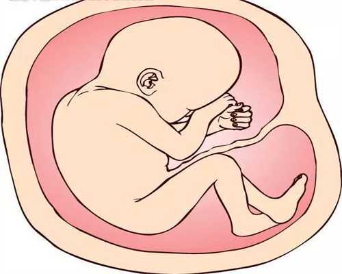 代孕包成功生双胞胎多少钱,孕晚期减少分娩痛苦